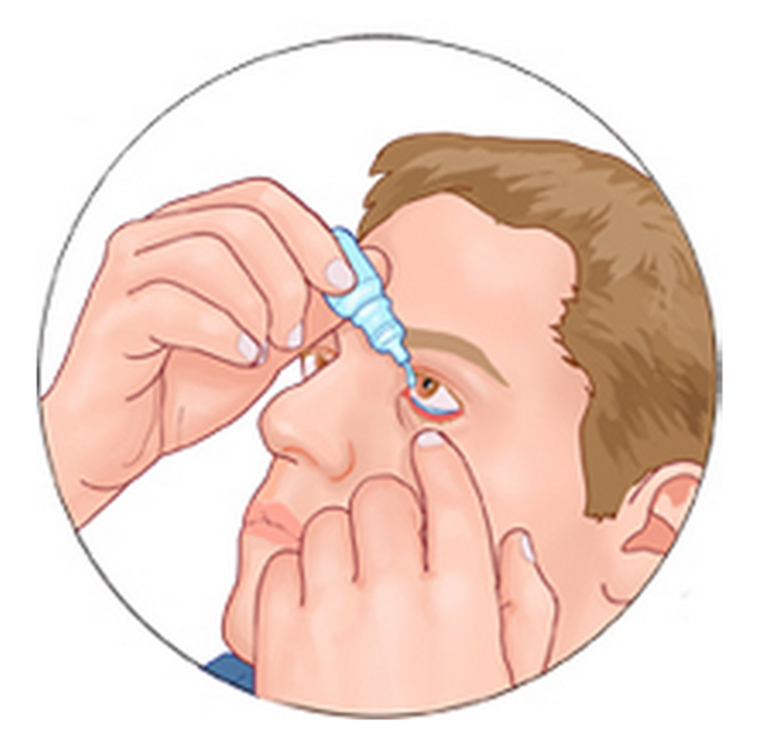 How to Use Eye Drops 如何使用眼药水 Dr. ZHOU, Peng
